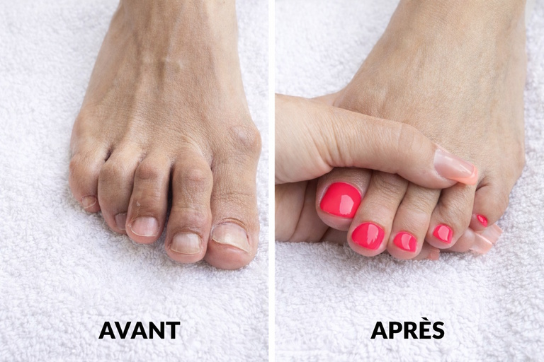 pédicure cosmetique